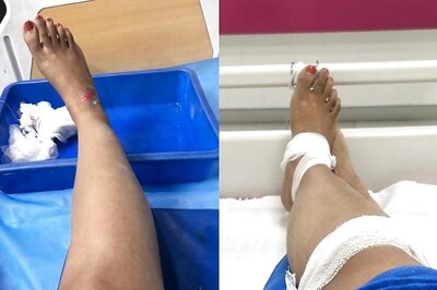 'Never Taking Rapido in My Life': Bengaluru Woman Injured in Collision Due to Reckless Rider