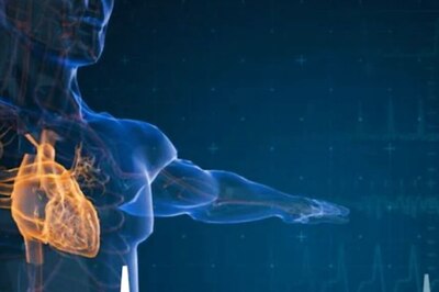 What is a Heart Attack? What Are Its Signs And Causes?