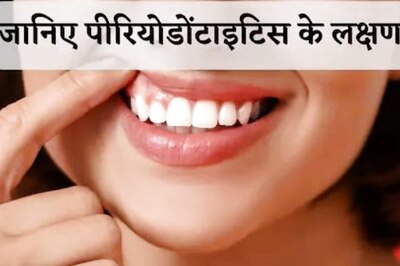 Keep A Watch On These Symptoms To Avoid Periodontitis