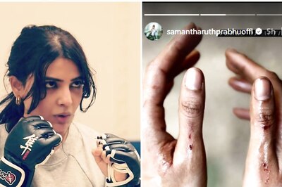 Samantha Ruth Prabhu Injures Herself While Shooting For Indian Version of Citadel