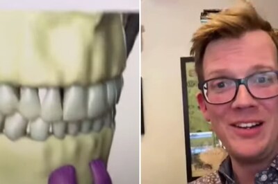 Internet Is Upset After Knowing About Chin Dimples, Here's How They Look