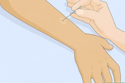 How to Ease Constipation with Acupuncture