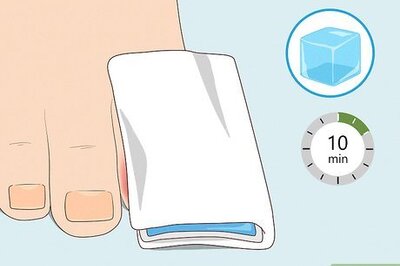How to Heal a Bruised Toe