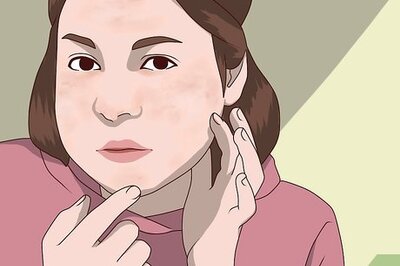 How to Know Skin Types