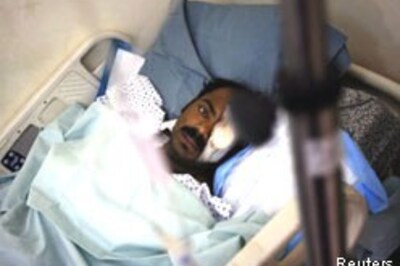 Indian pays price of a pizza in Iraq with an eye, leg