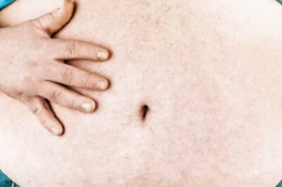 Fenugreek Cinnamon To Fennel Tea, Nutritionist Suggests Recipes For Weight Loss