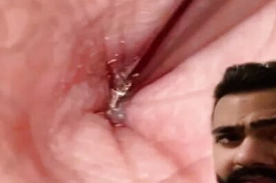 Here's Why you Should Clean Belly Button Daily