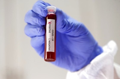 Roche Pharma Initiates Clinical Trial of Medicine ‘Actemra’ to Explore its Potential Use in Treating Covid-19 Patients