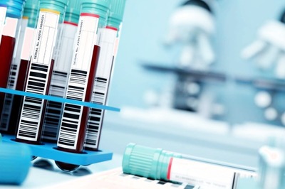 Curing with Blood: the Rise and Fall of Covid Convalescent Plasma Therapy