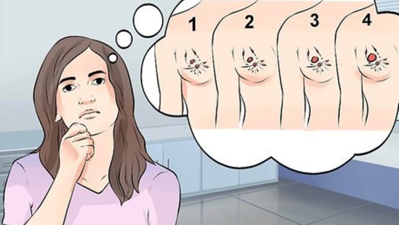 How to Cure Breast Cancer