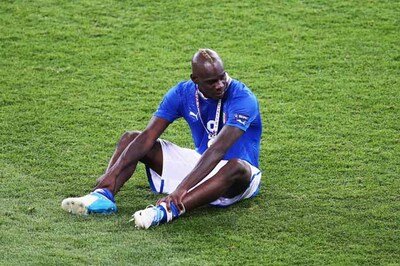 Man City striker Balotelli needs minor eye surgery