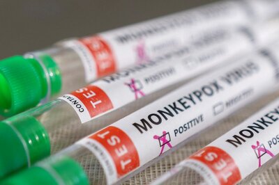 Monkeypox: All 15 Samples from Maharashtra Test Negative