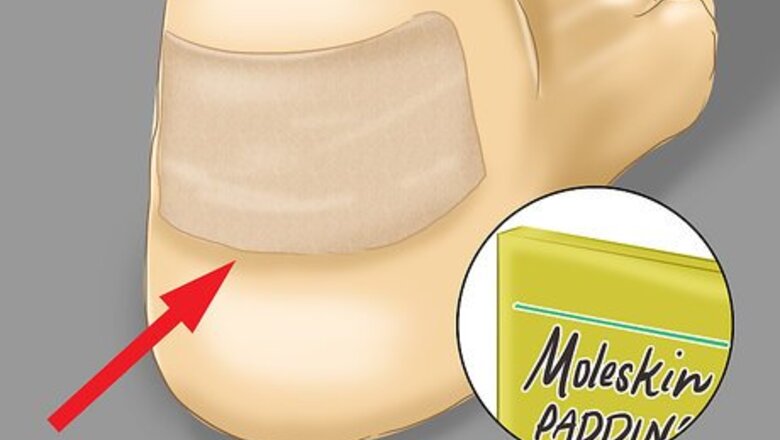 How to Prevent a Blood Blister