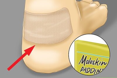 How to Prevent a Blood Blister