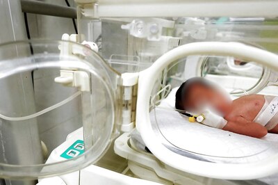 Baby 'Rouh', Saved From Dead Mother's Womb In Gaza Hospital, Dies Days After Birth