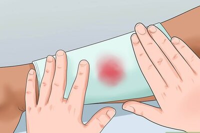 How to Splint a Fracture of the Lower Leg