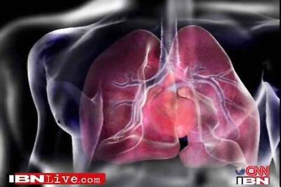 Tamil Nadu: 97-year-old woman undergoes angioplasty