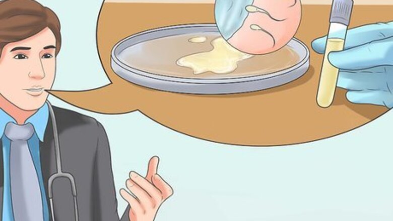 How to Prevent HIV Infection