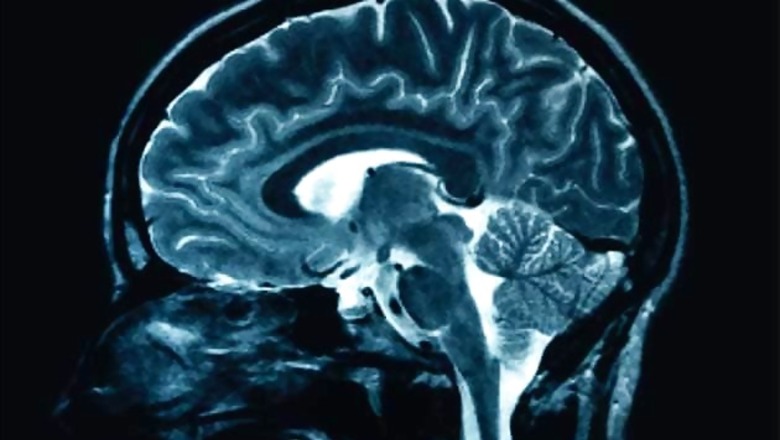 Decline of hearing ability: Indian, US experts find gene role