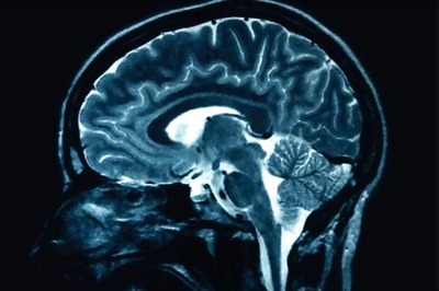 Decline of hearing ability: Indian, US experts find gene role