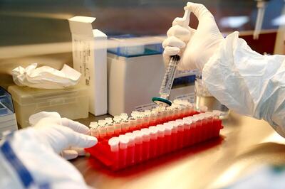 Two-thirds of Britons Would Get Vaccinated Against Coronavirus, Young Population Not So Keen: Poll