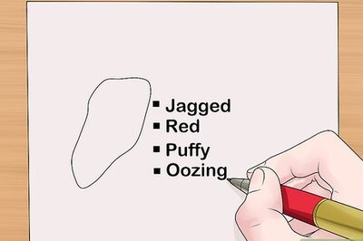 How to Measure Wounds