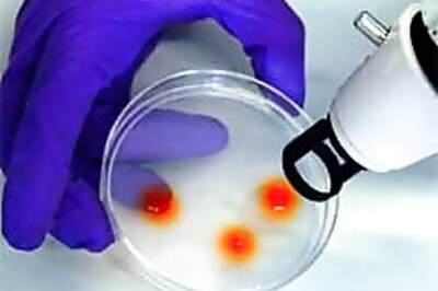 A new outsourcing to hit Indian labs