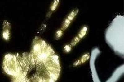 Three girls attacked with acid in Madhya Pradesh