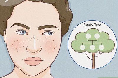 How to Give Yourself Totally Cute Freckles Safely