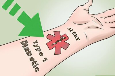 How to Get a Medical Tattoo