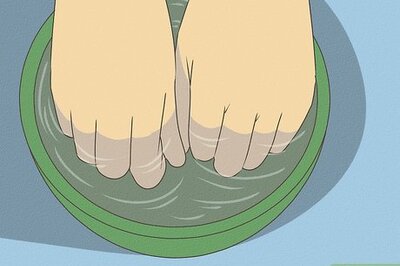 How to Get Rid of Calluses