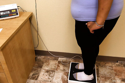 Fat ain't fit: Obesity a health hazard