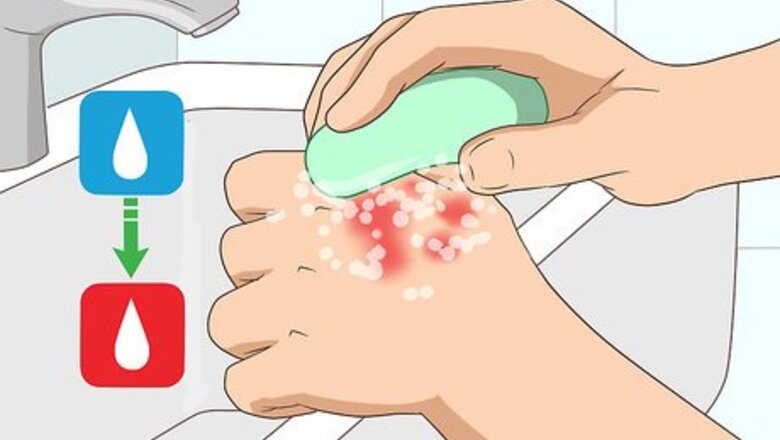 How to Heal Red Skin