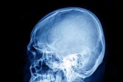 New Study Explains Evolution Of Human Ears And Teeth From Jurassic Era Period