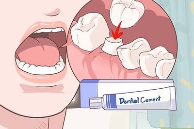 How to Fix a Lost Dental Crown