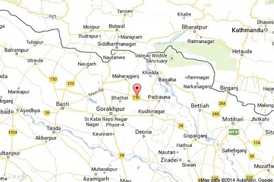 19-year-old girl set on fire over land dispute with father