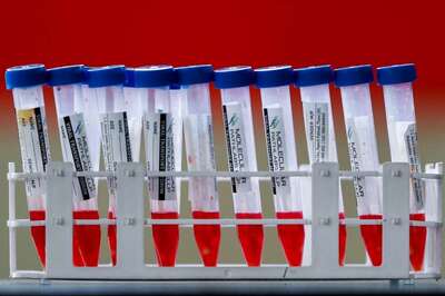 Karnataka to Investigate Negative Covid Report That Let S African Traveller With Omicron Fly Out