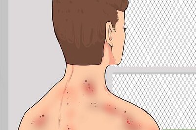How to Recognize Radiation Sickness