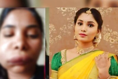 Endodontist Explains Possible Reason for Swathi Sathish's Root Canal Treatment That Went Wrong
