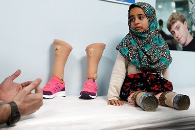 First New Steps for Syrian Girl Who Used Tin Cans for Legs