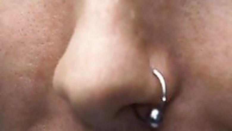 Man bites off wife's nose after brawl