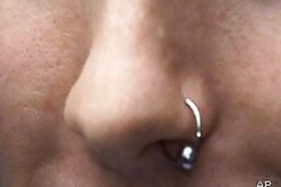 Man bites off wife's nose after brawl