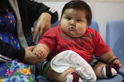 Anti Obesity Day: A Quarter of World's Total Population Will Be Obese By 2045