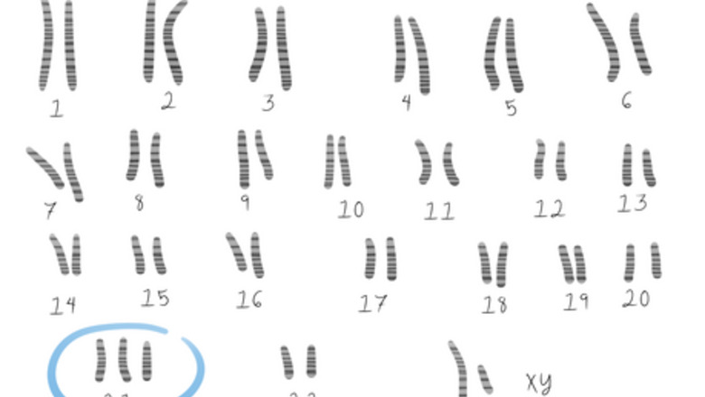 How to Deal with Diagnosis of a Rare Chromosome Disorder in a Child