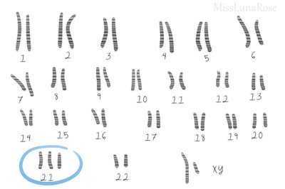 How to Deal with Diagnosis of a Rare Chromosome Disorder in a Child