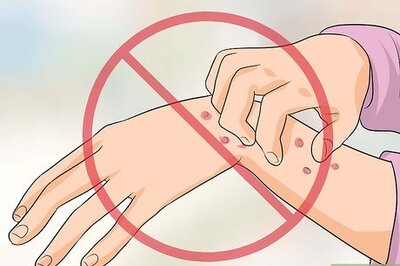 How to Relieve Itchy Hands and Feet at Night
