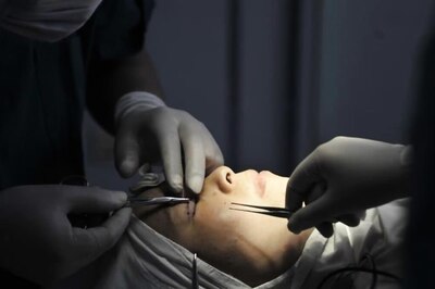 24 Plastic Surgeries in 24 Hours: This Delhi Hospital Achieves Groundbreaking Milestone