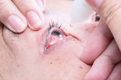 ‘Madras Eye’ Troubles Tamil Nadu as Nearly 4,000 Cases Being Reported Every Day This Monsoon