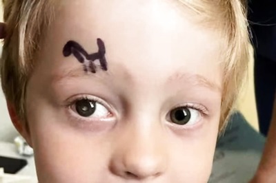 In England, How This Mother's Immense Courage Helped Son Overcome Eye Cancer