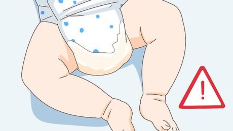 How to Change a Disposable Bedwetting Diaper
